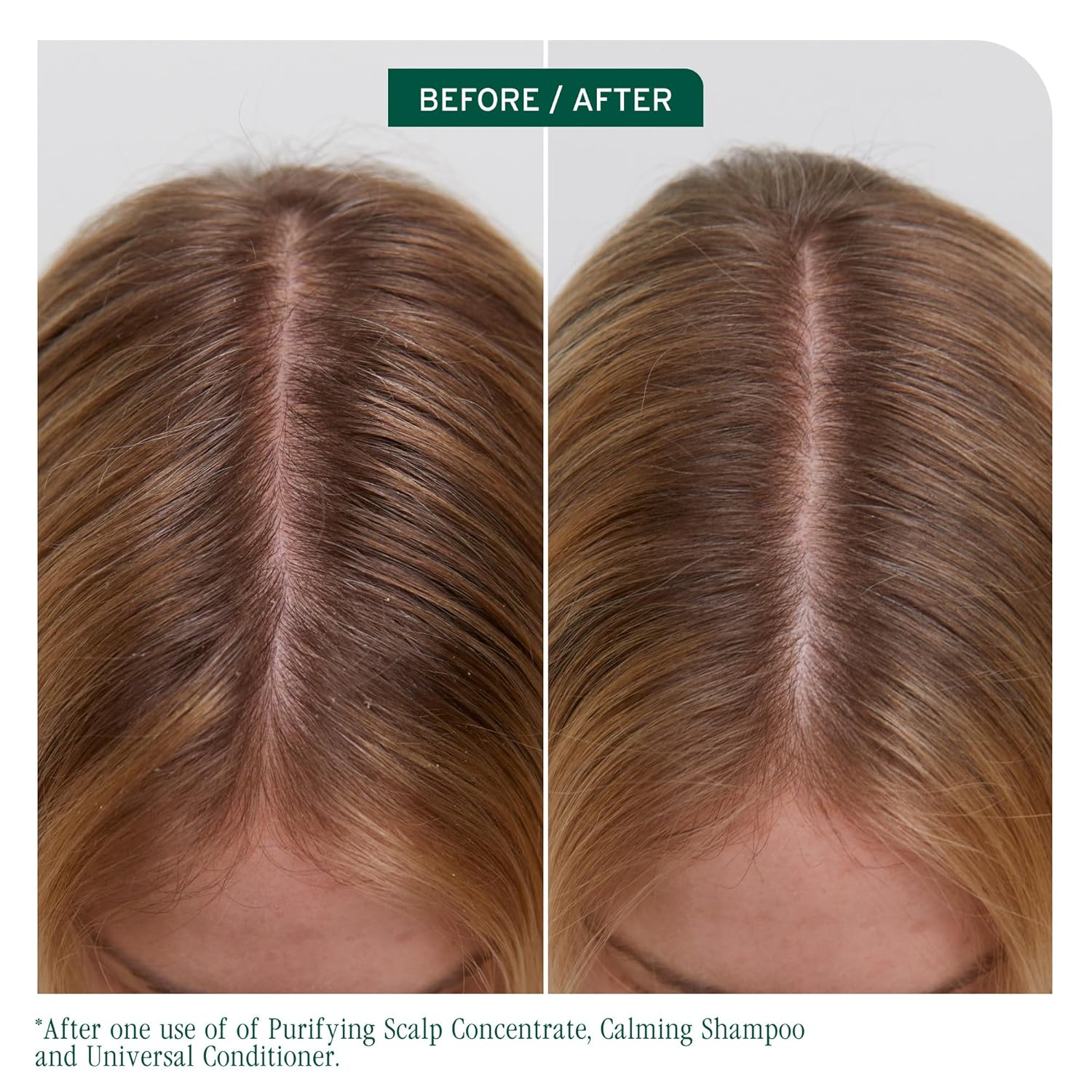 Biolage Scalp Sync Calming Shampoo – Soothes Sensitive, Dry Scalps