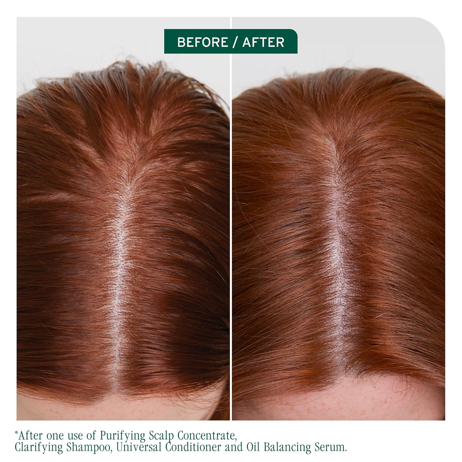 Biolage Scalp Sync Clarifying Shampoo – Deep Cleanse for Oily Scalp & Buildup Removal