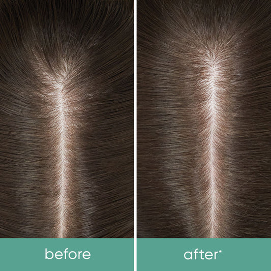 Biolage - Scalp Sync - Cooling Mint Shampoo