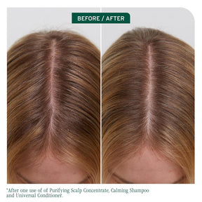 Biolage Scalp Sync Conditioner – Lightweight, Vegan, Paraben-Free Scalp Care for All Hair Types
