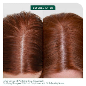 Biolage Scalp Sync Clarifying Shampoo – Deep Cleanse for Oily Scalp & Buildup Removal