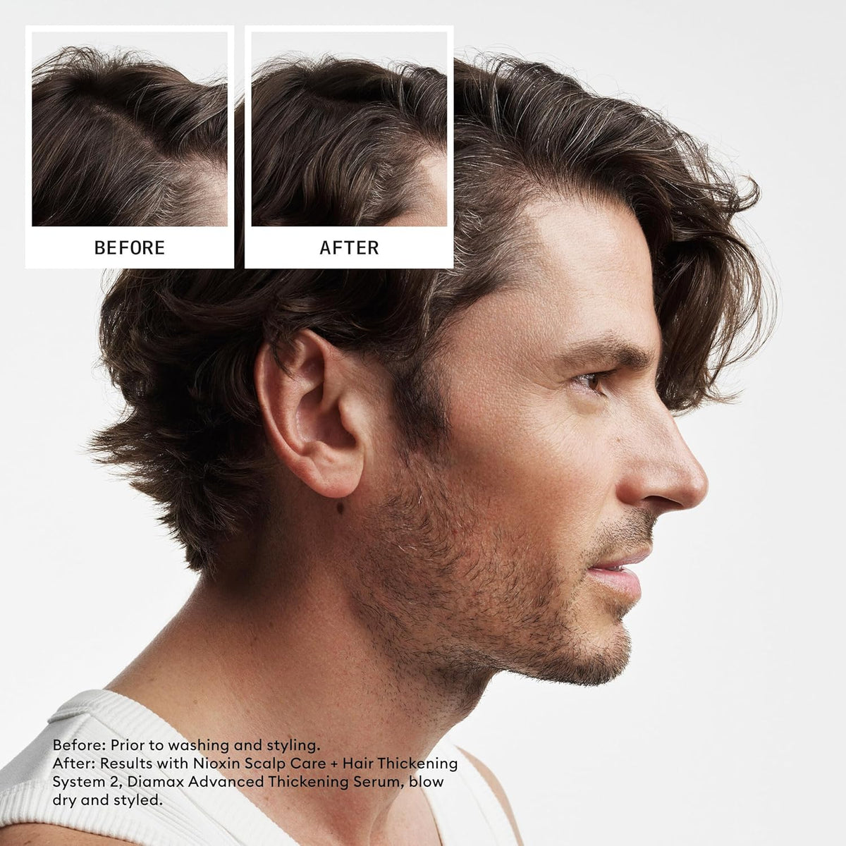Nioxin System 2 Scalp Therapy Revitalising Conditioner