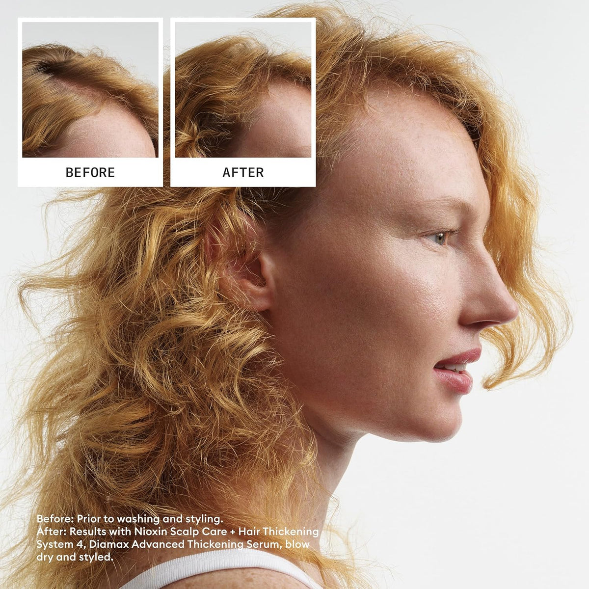Nioxin System 4 Hair System Kit