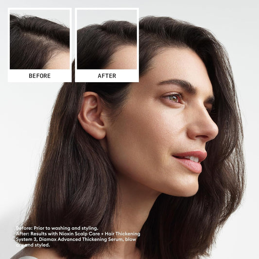 Nioxin System 3 Hair System Kit