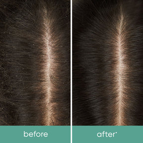 Biolage - Scalp Sync - Revitalisant