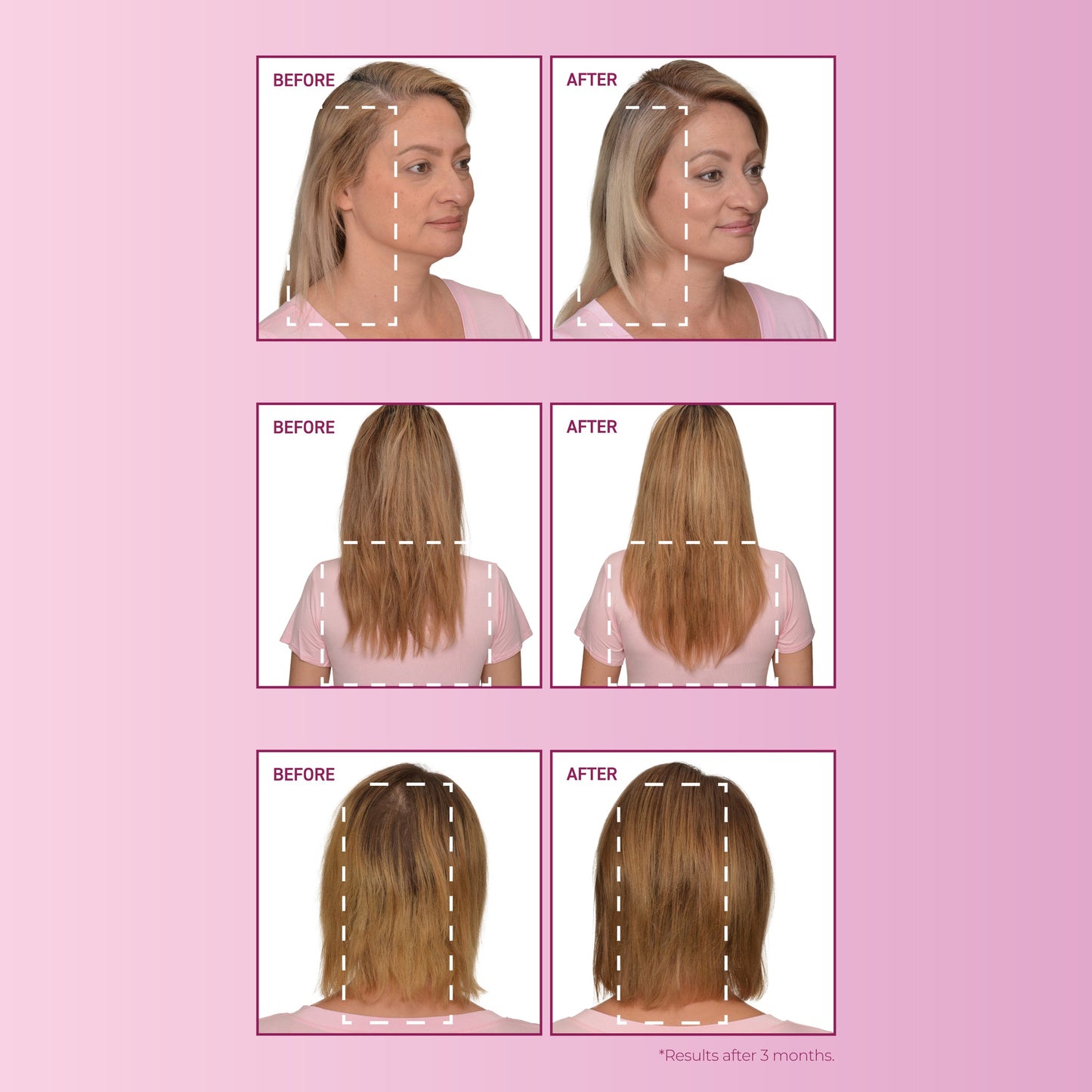BosleyMD mendXtend Strengthening System – current benefits image