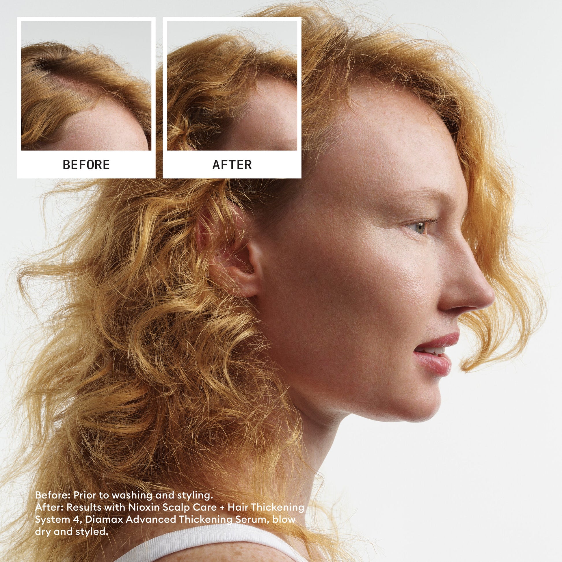Nioxin System 4 Hair System Kit – 3-Step Thickening Regimen for Colour-Treated Hair