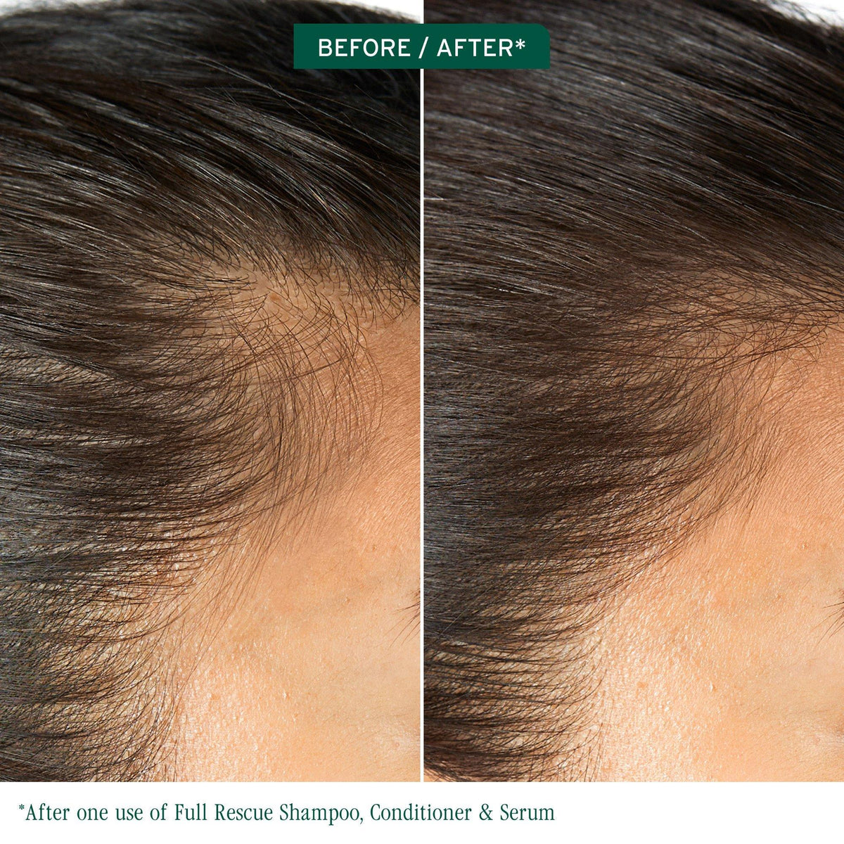 Biolage Full Rescue Invigorating Scalp Serum — before and after one use — visibly fuller, thicker-looking hair