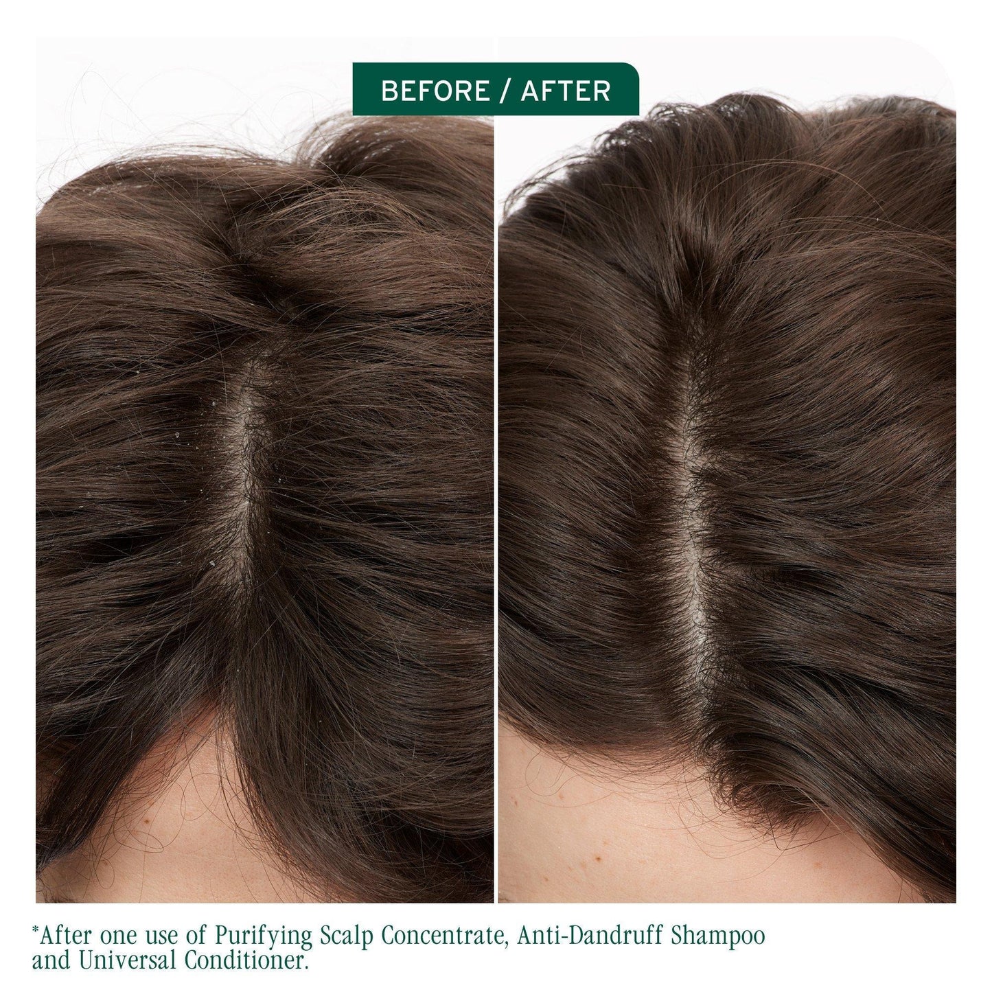 Biolage ScalpSync Purifying Scalp Concentrate — before and after on an oily scalp