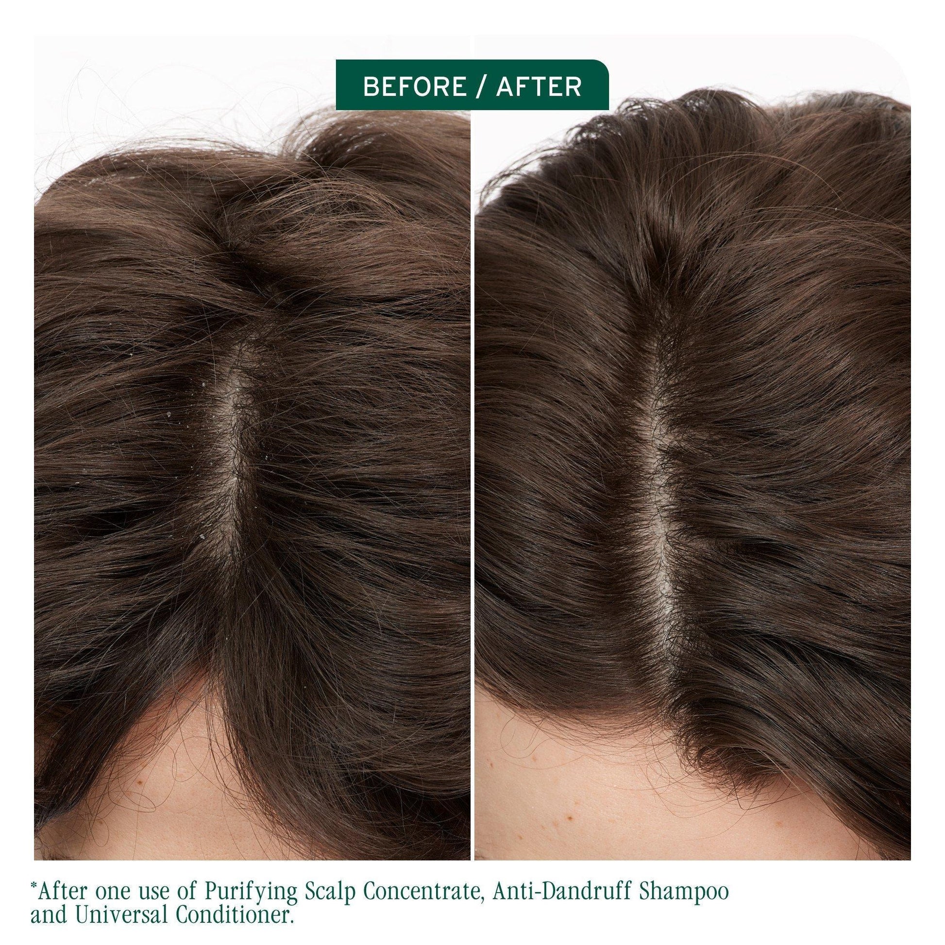 Biolage ScalpSync Purifying Scalp Concentrate — before and after on an oily scalp