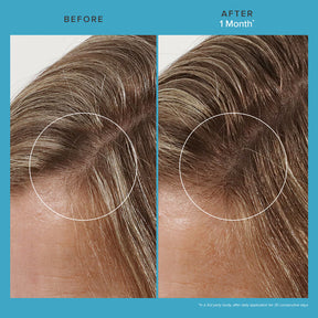 Living Proof Scalp Care Revitalizing Treatment - ProCare Outlet by Living Proof