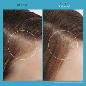 Living Proof Scalp Care Revitalizing Treatment - ProCare Outlet by Living Proof